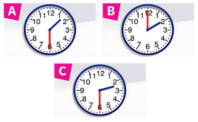 a2 - It was awesome r1 1