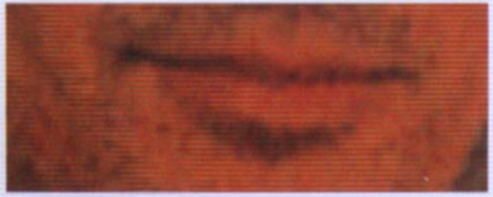 Read my Lips 2 - thin upper lips